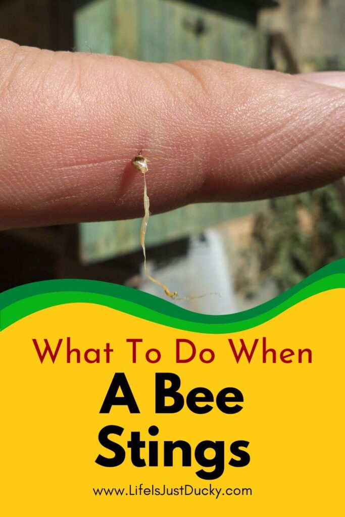 Finger with stinger in it. prevent bee stings